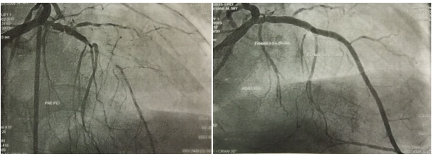 Gambar Prosedur Pemasangan PCI